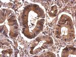 eIF4A1 Antibody in Immunohistochemistry (Paraffin) (IHC (P))