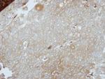 LIMS1 Antibody in Immunohistochemistry (Paraffin) (IHC (P))