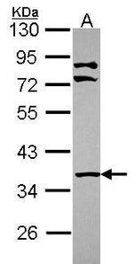 LIMS1 Antibody in Western Blot (WB)