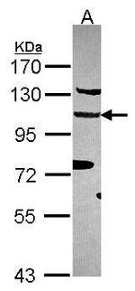 EFTUD2 Antibody in Western Blot (WB)