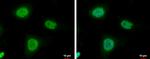 IGF2BP3 Antibody in Immunocytochemistry (ICC/IF)