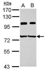 IGF2BP3 Antibody in Western Blot (WB)