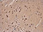 SAM68 Antibody in Immunohistochemistry (Paraffin) (IHC (P))