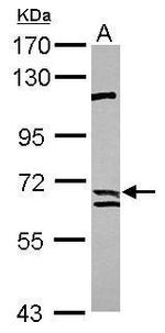 Calpain 9 Antibody in Western Blot (WB)