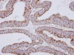 MRPS27 Antibody in Immunohistochemistry (Paraffin) (IHC (P))