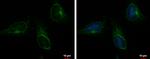 ACOT9 Antibody in Immunocytochemistry (ICC/IF)