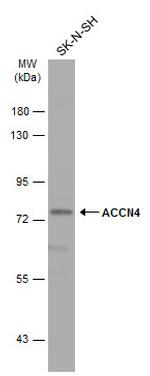ASIC4 Antibody in Western Blot (WB)
