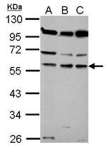 Coronin 1B Antibody in Western Blot (WB)