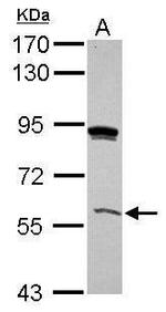 GRHL3 Antibody in Western Blot (WB)