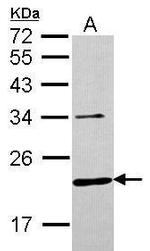 CHMP6 Antibody in Western Blot (WB)