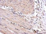 VLK Antibody in Immunohistochemistry (Paraffin) (IHC (P))