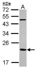 FTMT Antibody in Western Blot (WB)