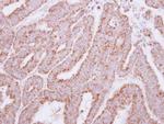 HAGH Antibody in Immunohistochemistry (Paraffin) (IHC (P))