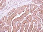 RRP4 Antibody in Immunohistochemistry (Paraffin) (IHC (P))