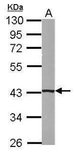 B4GALT5 Antibody in Western Blot (WB)