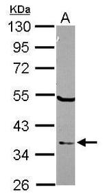 ELAC1 Antibody in Western Blot (WB)