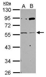 CHRNG Antibody in Western Blot (WB)