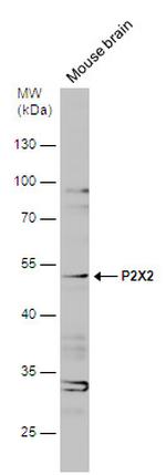 P2X2 Antibody in Western Blot (WB)