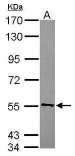 CYB5R4 Antibody in Western Blot (WB)