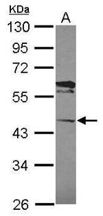 LACC1 Antibody in Western Blot (WB)