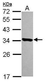 HDHD3 Antibody in Western Blot (WB)