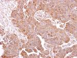 METTL13 Antibody in Immunohistochemistry (Paraffin) (IHC (P))