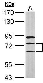 METTL13 Antibody in Western Blot (WB)