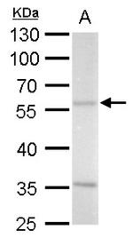 ADC Antibody in Western Blot (WB)