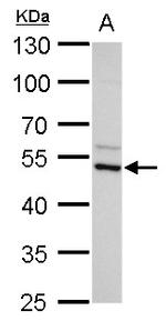 ADC Antibody in Western Blot (WB)