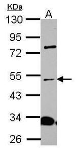ICA1L Antibody in Western Blot (WB)
