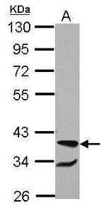 RBM4 Antibody in Western Blot (WB)