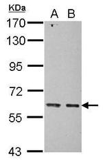 KIAA0391 Antibody in Western Blot (WB)