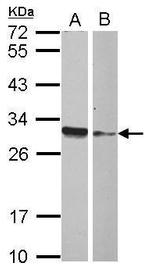 HMGB4 Antibody in Western Blot (WB)