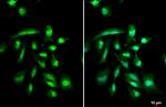 GLI1 Antibody in Immunocytochemistry (ICC/IF)