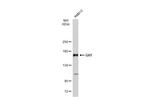 GLI1 Antibody in Western Blot (WB)