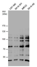 GLI1 Antibody in Western Blot (WB)