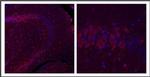 GLI1 Antibody in Immunohistochemistry (Paraffin) (IHC (P))