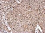 GLI1 Antibody in Immunohistochemistry (Paraffin) (IHC (P))