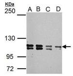 GLI1 Antibody in Western Blot (WB)