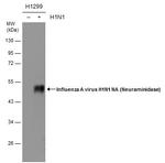 Influenza A H1N1 NA Antibody in Western Blot (WB)