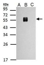 Dengue Virus Type 2 Envelope Antibody in Western Blot (WB)