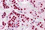 COMT Antibody in Immunohistochemistry (Paraffin) (IHC (P))