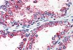 HTR2A Antibody in Immunohistochemistry (Paraffin) (IHC (P))