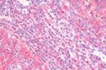 ITGA4 Antibody in Immunohistochemistry (Paraffin) (IHC (P))