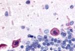 ADORA1 Antibody in Immunohistochemistry (Paraffin) (IHC (P))