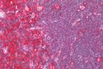 CCR6 Antibody in Immunohistochemistry (Paraffin) (IHC (P))