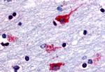 CHRM2 Antibody in Immunohistochemistry (Paraffin) (IHC (P))