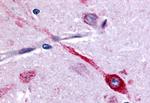 CHRM2 Antibody in Immunohistochemistry (Paraffin) (IHC (P))