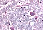 CRHR1 Antibody in Immunohistochemistry (Paraffin) (IHC (P))