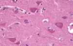 FZD3 Antibody in Immunohistochemistry (Paraffin) (IHC (P))